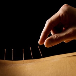 The Science Behind Dry Needling to cure chronic pain and emotional trauma
